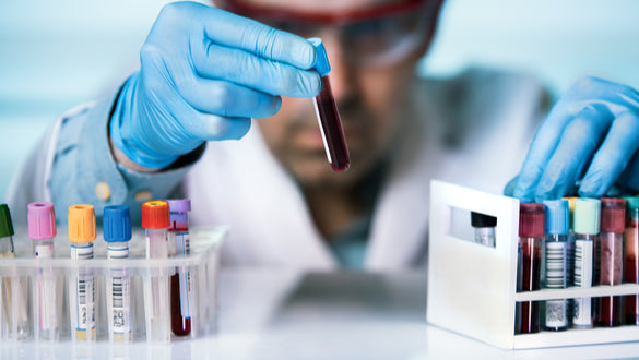 New Blood Test Can Predict Heart Attacks Years In Advance